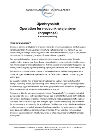 Operation for øjenbrynsløft PDF