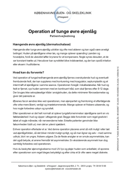 Operation af tunge øvre øjenlåg PDF